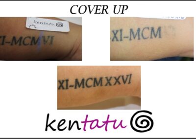 Coverup